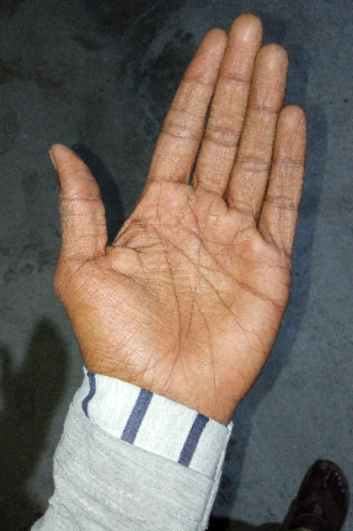 అరచేతి రేఖలు