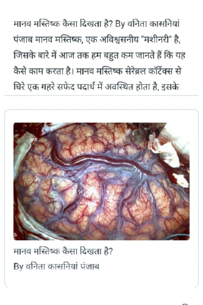 मानव मस्तिष्क कैसा दिखता है?

By वनिता कासनियां पंजाब

मानव मस्तिष्क, एक अविश्वसनीय "मशीनरी" है, जिसके बारे में आज तक हम बहुत कम जानते हैं कि यह कैसे
