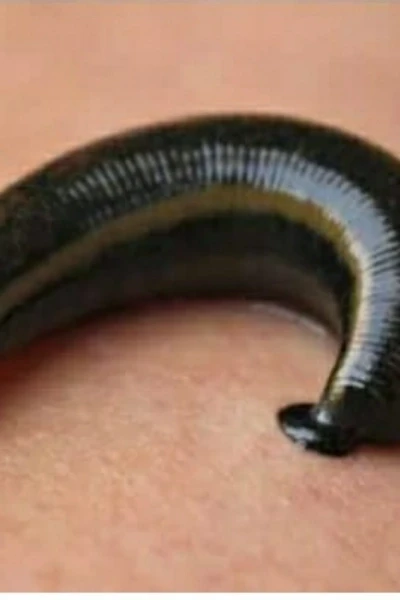 അട്ട (കവിത)