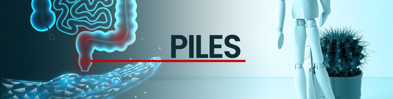 మూల వ్యాధి లేదా మొలలు  (పైల్స్ ,మూల శంక )కి సహజ సిద్దమైన చికిత్స విధానాలు