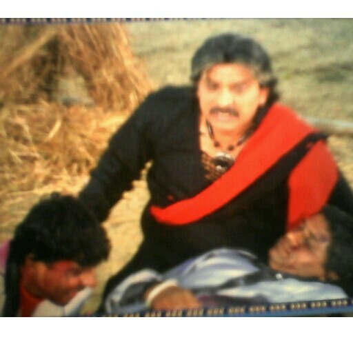 બાળોતિયાનો બળેલો ભાગ- ૧ થી ૩