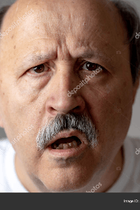 અલ્ઝાઇમર